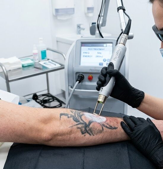 Kadr z gabinetu zabiegowego, skupiający się na głowicy nowoczesnego lasera pikosekundowego skierowanej na przedramię z wyblakłym, czarnym tatuażem.